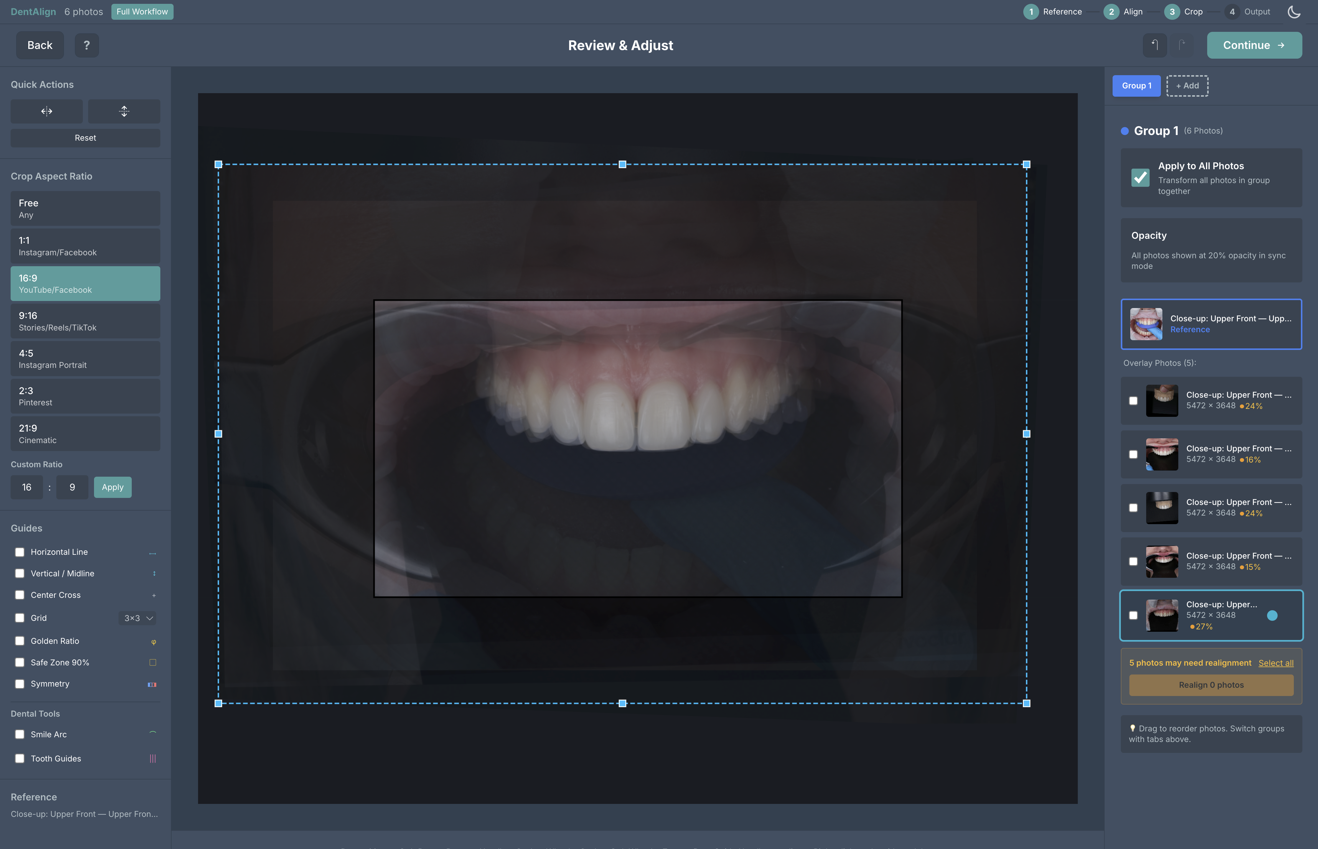Tutorials - DentAlign
